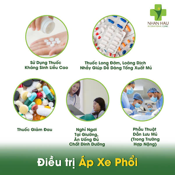 Điều trị Áp Xe Phổi