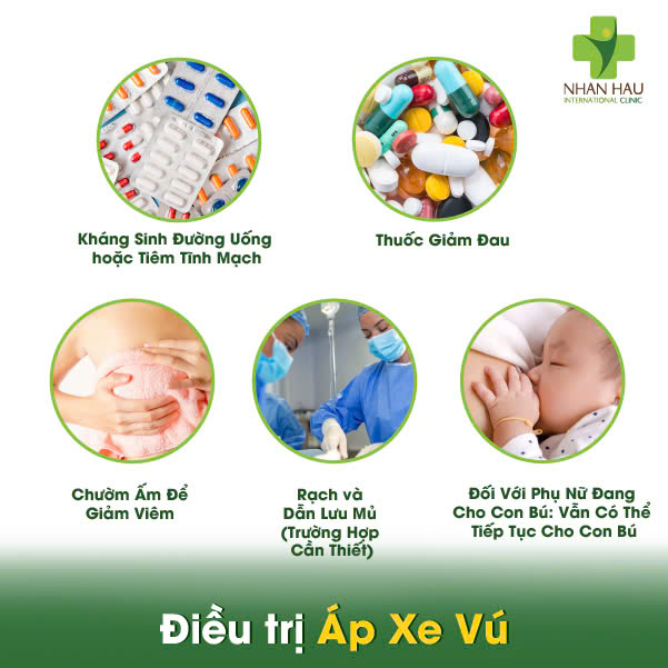 Điều trị Áp Xe Vú