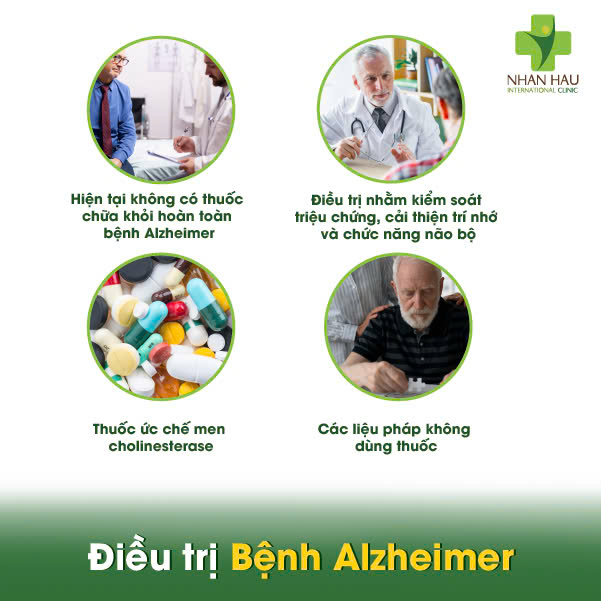 Điều trị Bệnh Alzheimer