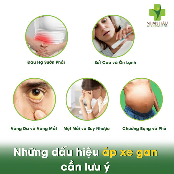 Những dấu hiệu áp xe gan cần lưu ý