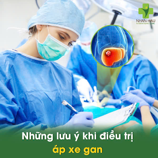 Những lưu ý khi điều trị áp xe gan