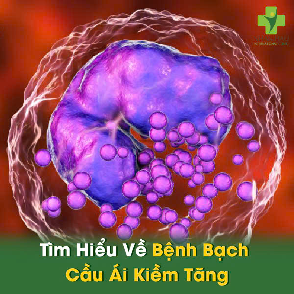 Tìm Hiểu Về Bệnh Bạch Cầu Ái Kiềm Tăng