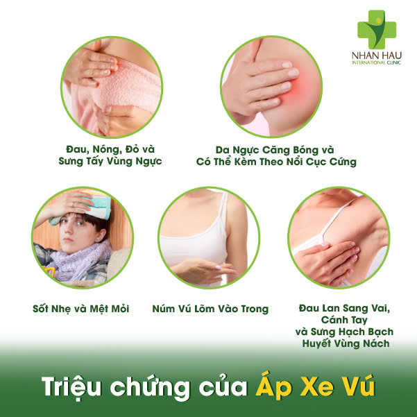 Triệu chứng của Áp Xe Vú