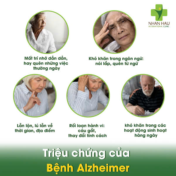 Triệu chứng của Bệnh Alzheimer