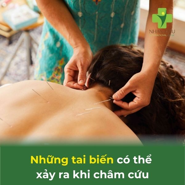 tai biến do châm cứu