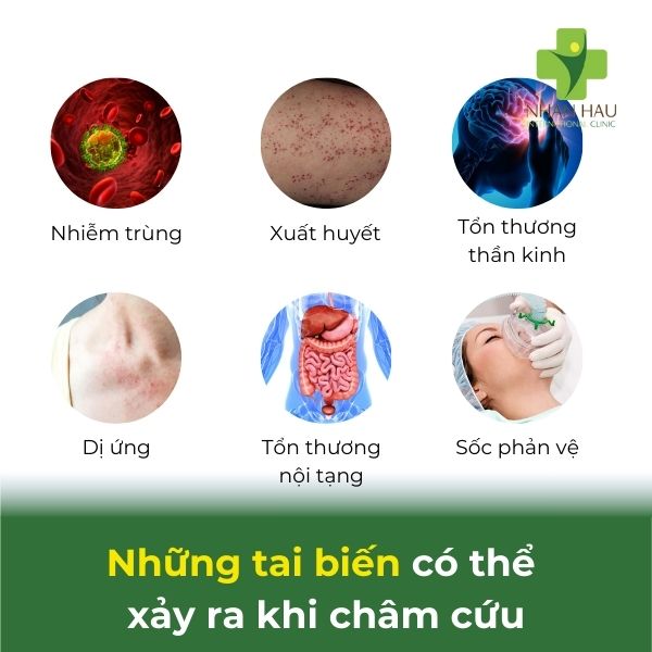 tai biến của châm cứu