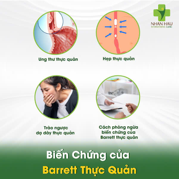 Biến Chứng của Barrett Thực Quản