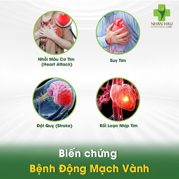 Biến chứng Bệnh Động Mạch Vành