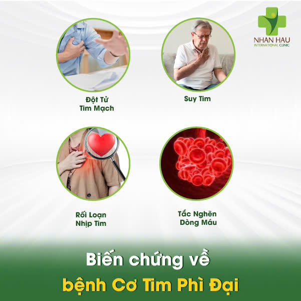 Biến chứng về bệnh Cơ Tim Phì Đại