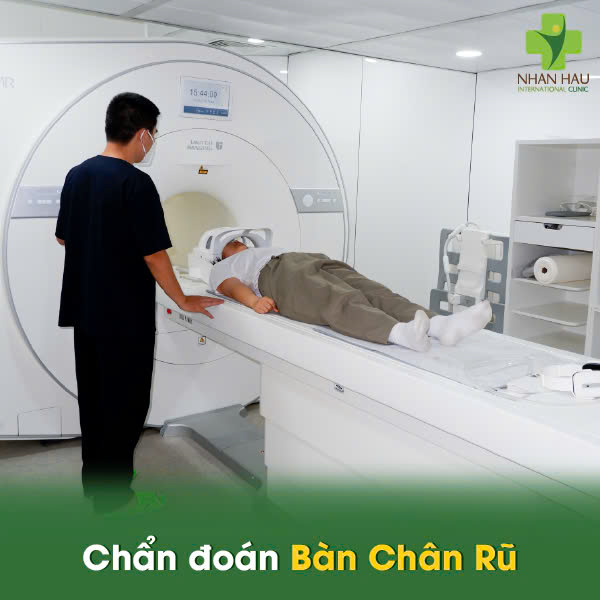 Chẩn đoán Bàn Chân Rũ