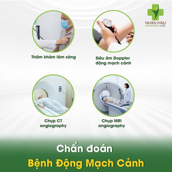 Chẩn đoán Bệnh Động Mạch Cảnh