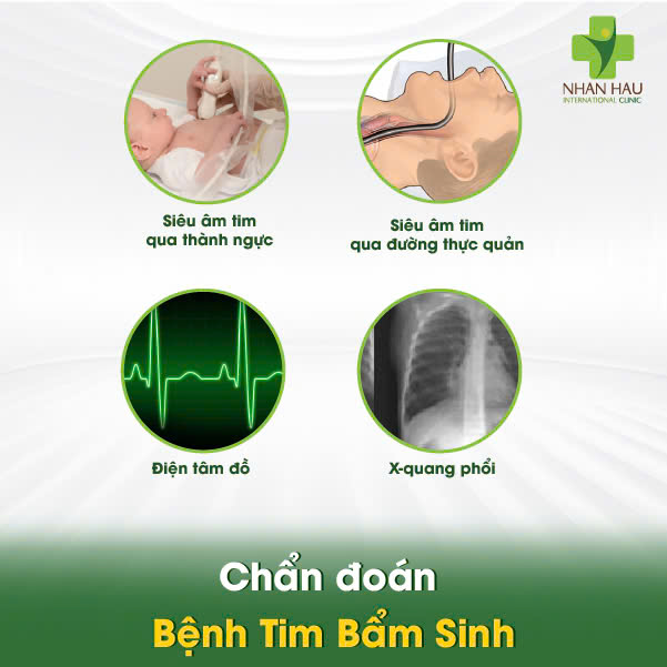 Chẩn đoán Bệnh Tim Bẩm Sinh