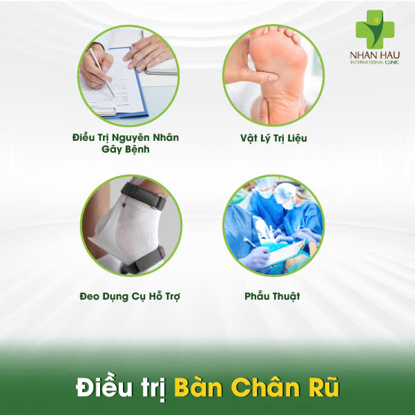 Điều trị Bàn Chân Rũ