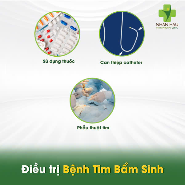 Điều trị Bệnh Tim Bẩm Sinh