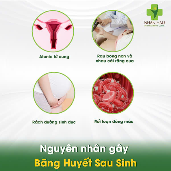 Nguyên nhân gây Băng Huyết Sau Sinh