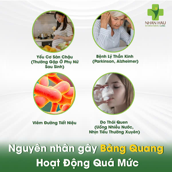 Nguyên nhân gây Bàng Quang Hoạt Động Quá Mức