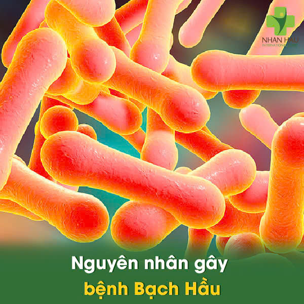 Nguyên nhân gây bệnh Bạch Hầu