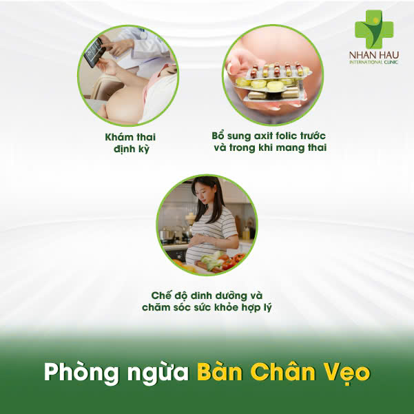 Phòng ngừa Bàn Chân Vẹo