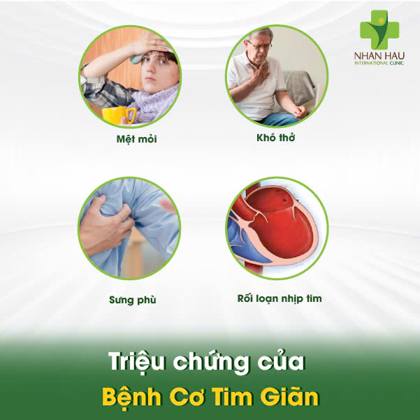 Triệu chứng của Bệnh Cơ Tim Giãn