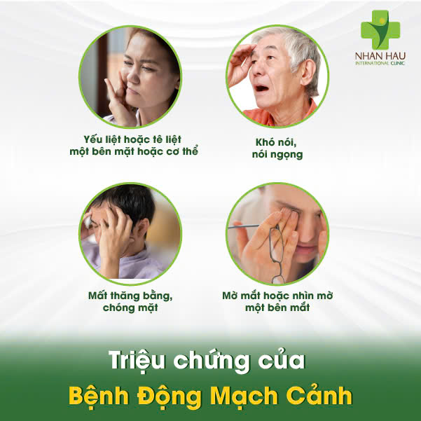 Triệu chứng của Bệnh Động Mạch Cảnh