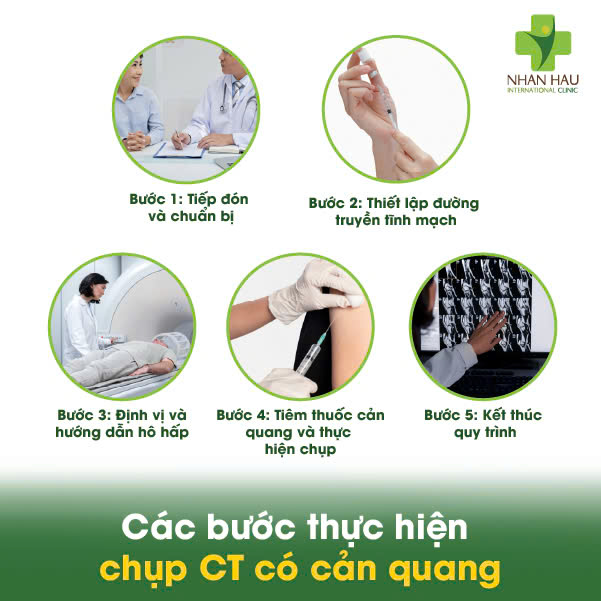 Chụp CT có cản quang: Quy trình, Lợi ích và Những lưu ý quan trọng 4 Các bước thực hiện chụp CT có cản quang