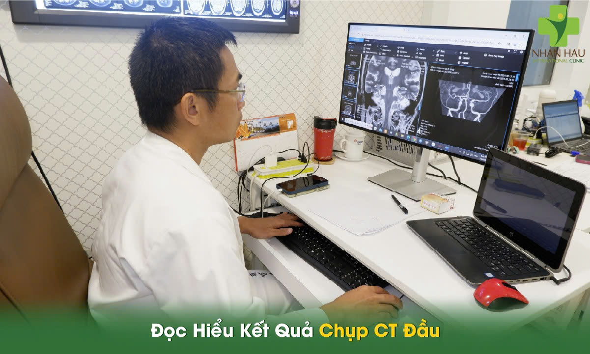 Chụp CT Đầu: Hướng Dẫn Toàn Diện Từ Chuyên Gia Y Tế 6 Đọc Hiểu Kết Quả Chụp CT Đầu