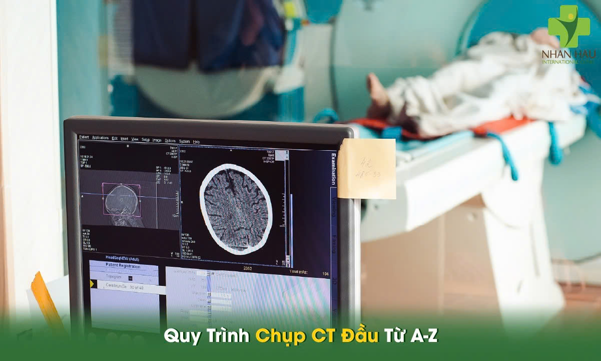 Chụp CT Đầu: Hướng Dẫn Toàn Diện Từ Chuyên Gia Y Tế 5 Quy Trình Chụp CT Đầu Từ A-Z