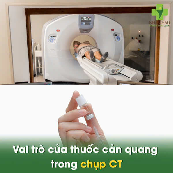 Chụp CT có cản quang: Quy trình, Lợi ích và Những lưu ý quan trọng 2 Vai trò của thuốc cản quang trong chụp CT