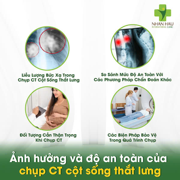 Chụp CT Cột Sống Thắt Lưng: Chi Phí, Quy Trình, Và Những Điều Cần Biết 6 Ảnh hưởng và độ an toàn của chụp CT cột sống thắt lưng