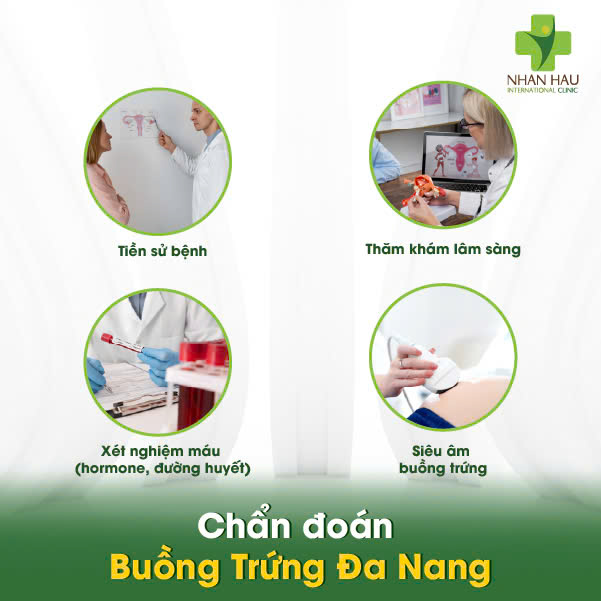 Buồng Trứng Đa Nang: Hiểu Rõ Triệu Chứng, Buồng Trứng Đa Nang: Hiểu Rõ Triệu Chứng 4 Chẩn đoán Buồng Trứng Đa Nang