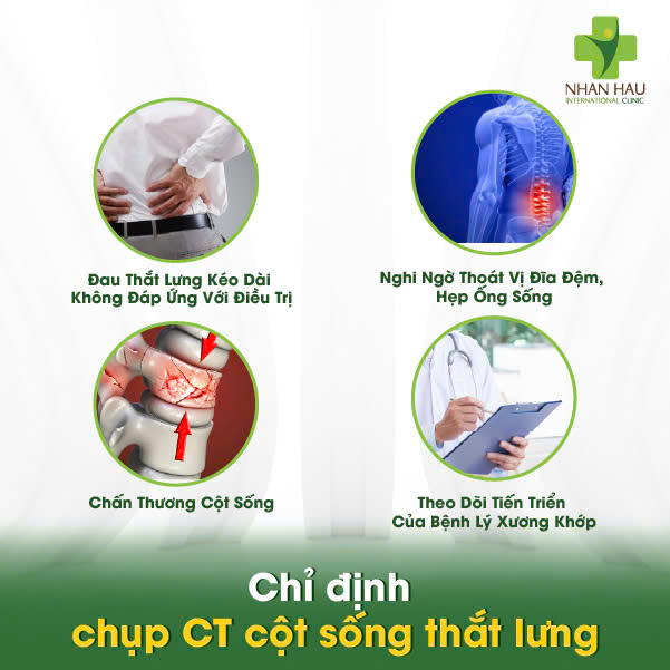 Chụp CT Cột Sống Thắt Lưng: Chi Phí, Quy Trình, Và Những Điều Cần Biết 2 Chỉ định chụp CT cột sống thắt lưng