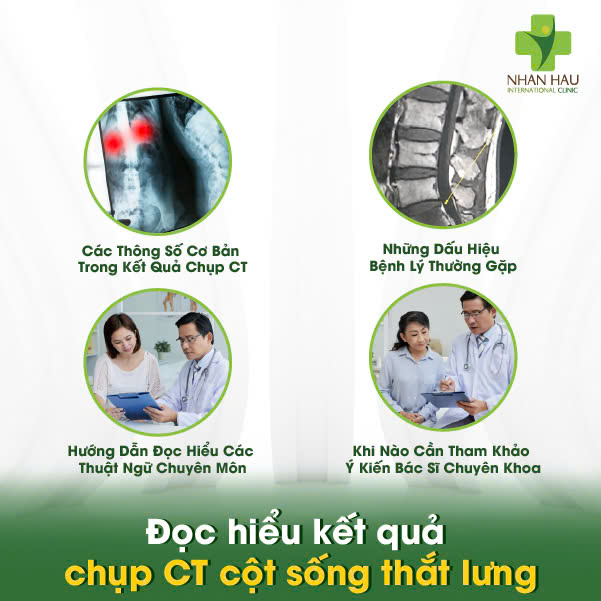 Đọc hiểu kết quả chụp CT cột sống thắt lưng