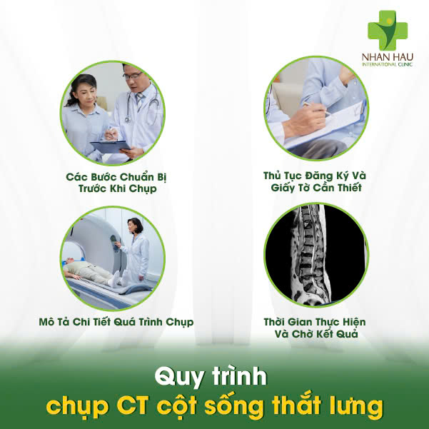 Chụp CT Cột Sống Thắt Lưng: Chi Phí, Quy Trình, Và Những Điều Cần Biết 4 Quy trình chụp CT cột sống thắt lưng