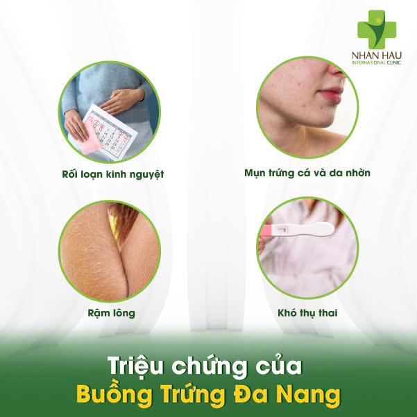 Buồng Trứng Đa Nang: Hiểu Rõ Triệu Chứng, Buồng Trứng Đa Nang: Hiểu Rõ Triệu Chứng 3 Triệu chứng của Buồng Trứng Đa Nang