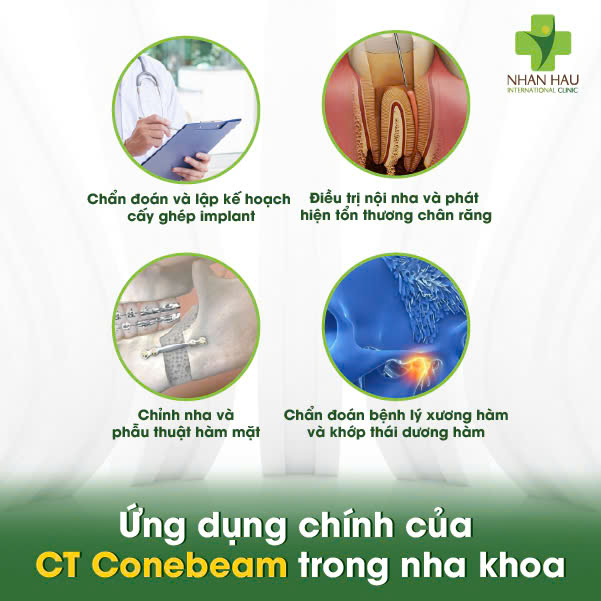 Chụp CT Conebeam: Hướng Dẫn Toàn Diện về Quy Trình, Chi Phí và Ứng Dụng Trong Nha Khoa 2 Ứng dụng chính của CT Conebeam trong nha khoa