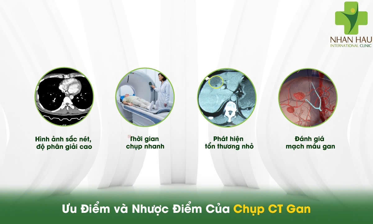 Chụp CT Gan: Hướng Dẫn Toàn Diện Từ A-Z Cho Người Bệnh 7 Ưu Điểm và Nhược Điểm Của Chụp CT Gan