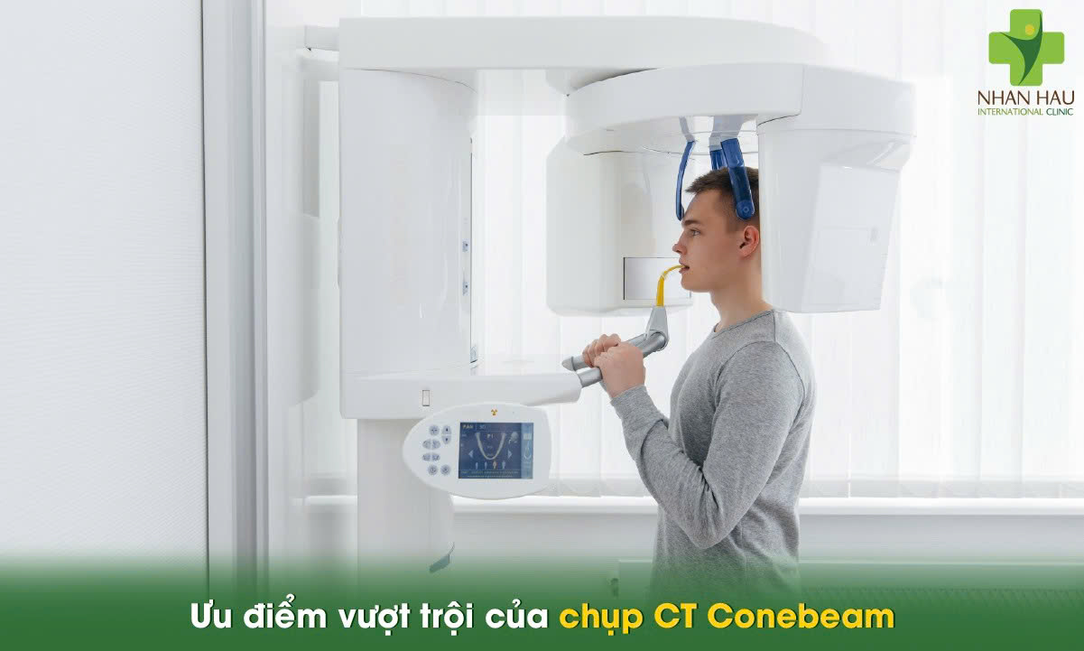 Chụp CT Conebeam là gì? Hướng dẫn toàn diện về công nghệ hình ảnh 3D trong nha khoa 2 Ưu điểm vượt trội của chụp CT Conebeam