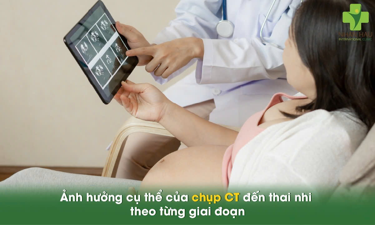 Chụp CT có ảnh hưởng đến thai nhi không? Chuyên gia giải đáp 2 Ảnh hưởng cụ thể của chụp CT đến thai nhi theo từng giai đoạn