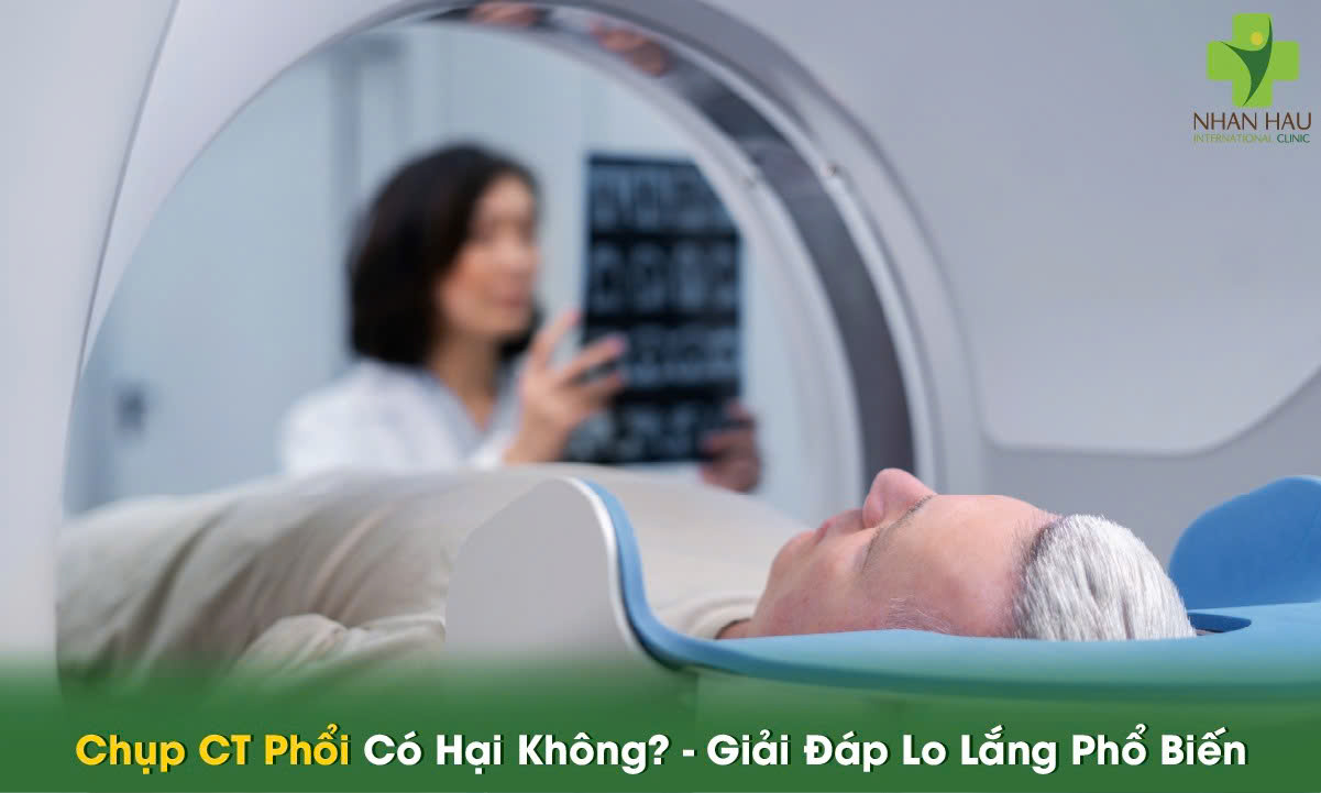 Chụp CT Phổi Có Hại Không? - Giải Đáp Lo Lắng Phổ Biến