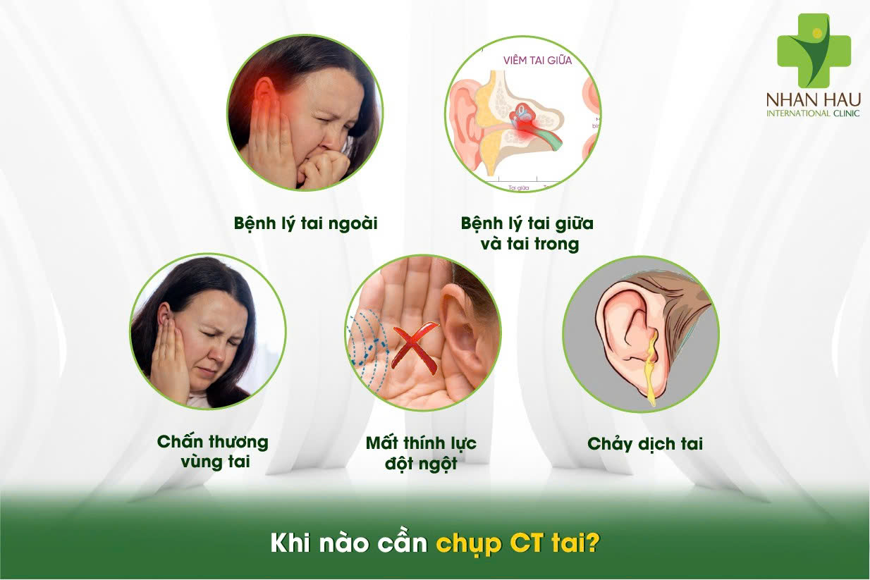 Chụp CT tai: Phương pháp chẩn đoán chính xác bệnh lý tai mũi họng 2 Khi nào cần chụp CT tai?