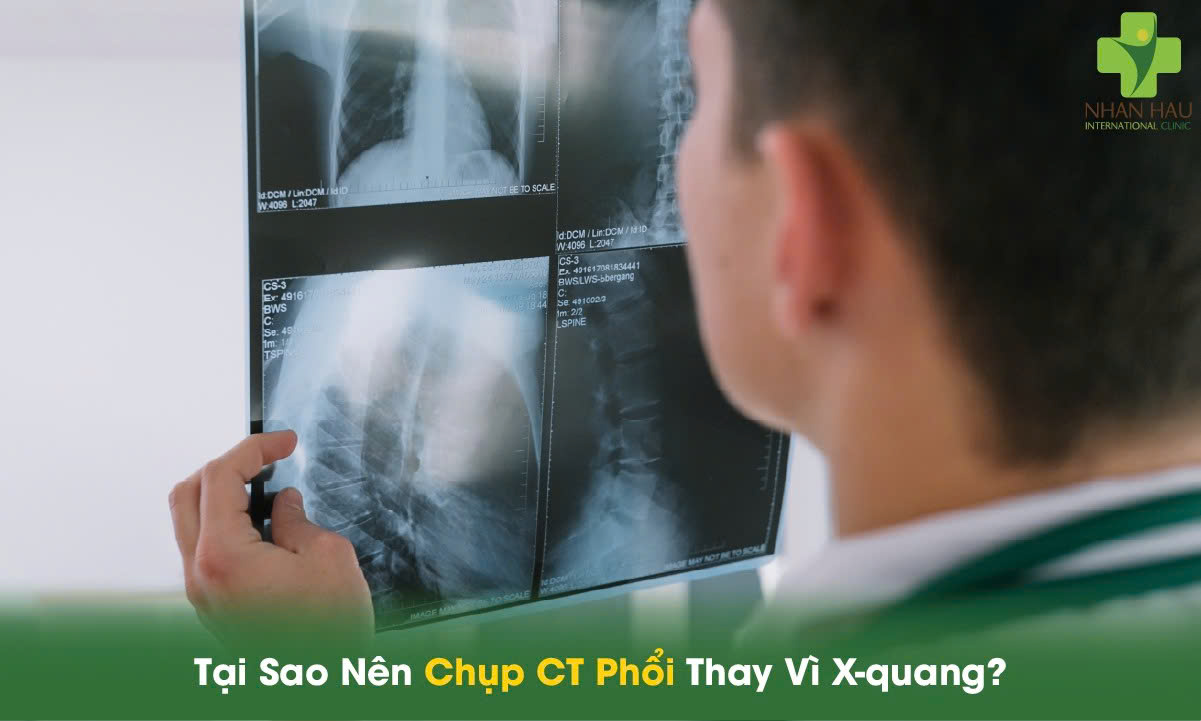Tại Sao Nên Chụp CT Phổi Thay Vì X-quang?