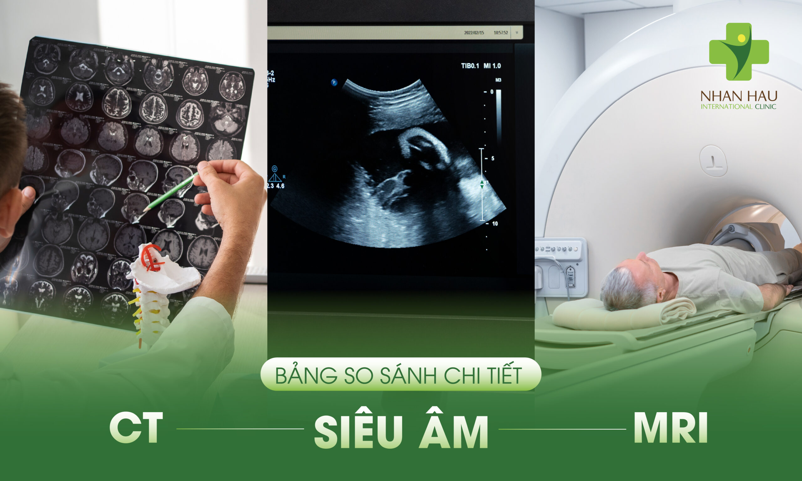 Bảng So Sánh Chi Tiết CT, MRI và Siêu Âm