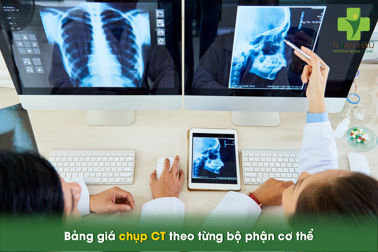 Chụp CT giá bao nhiêu? Bảng giá chi tiết và cách tiết kiệm chi phí 2 Bảng giá chụp CT theo từng bộ phận cơ thể