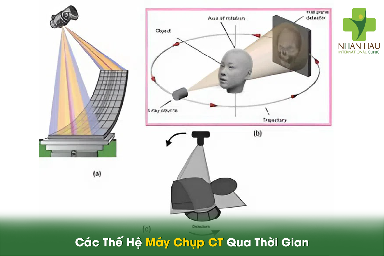 Các Thế Hệ Máy Chụp CT Qua Thời Gian
