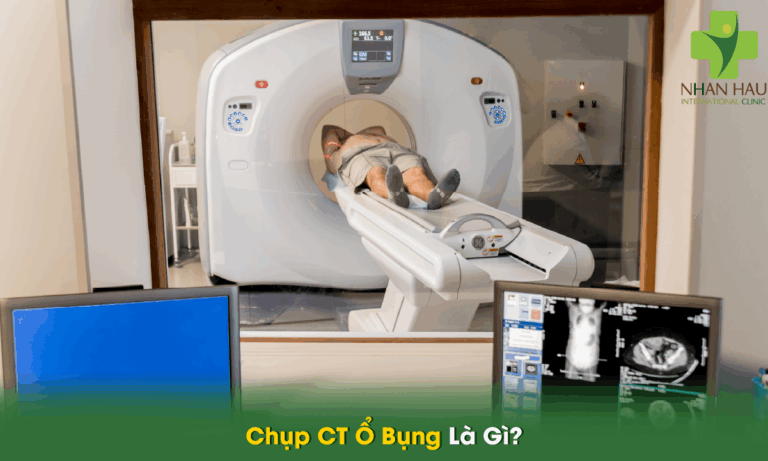 Chụp CT Ổ Bụng Là Gì?