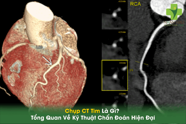 Chụp CT Tim Là Gì? Tổng Quan Về Kỹ Thuật Chẩn Đoán Hiện Đại