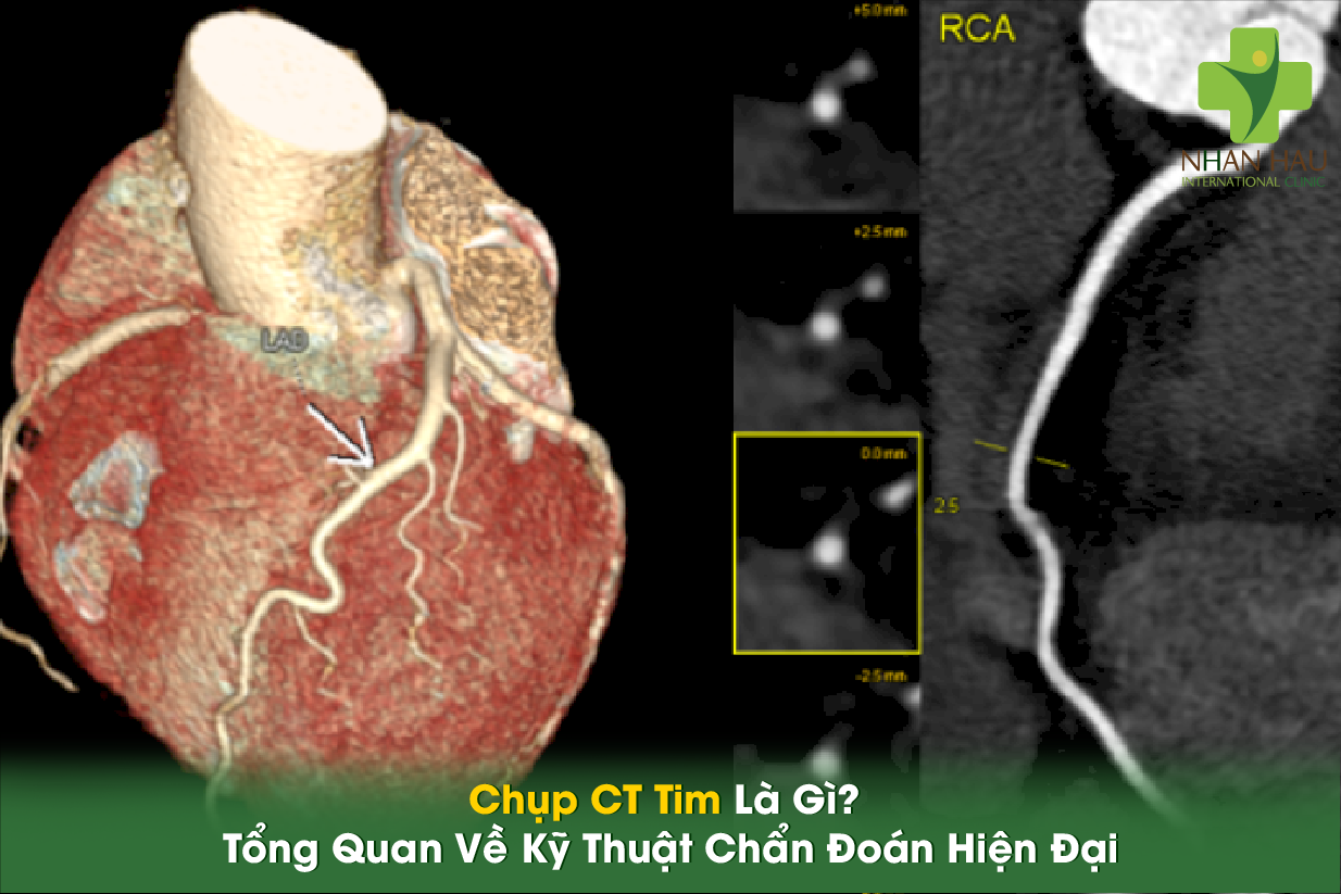 Chụp CT Tim Là Gì? Tổng Quan Về Kỹ Thuật Chẩn Đoán Hiện Đại