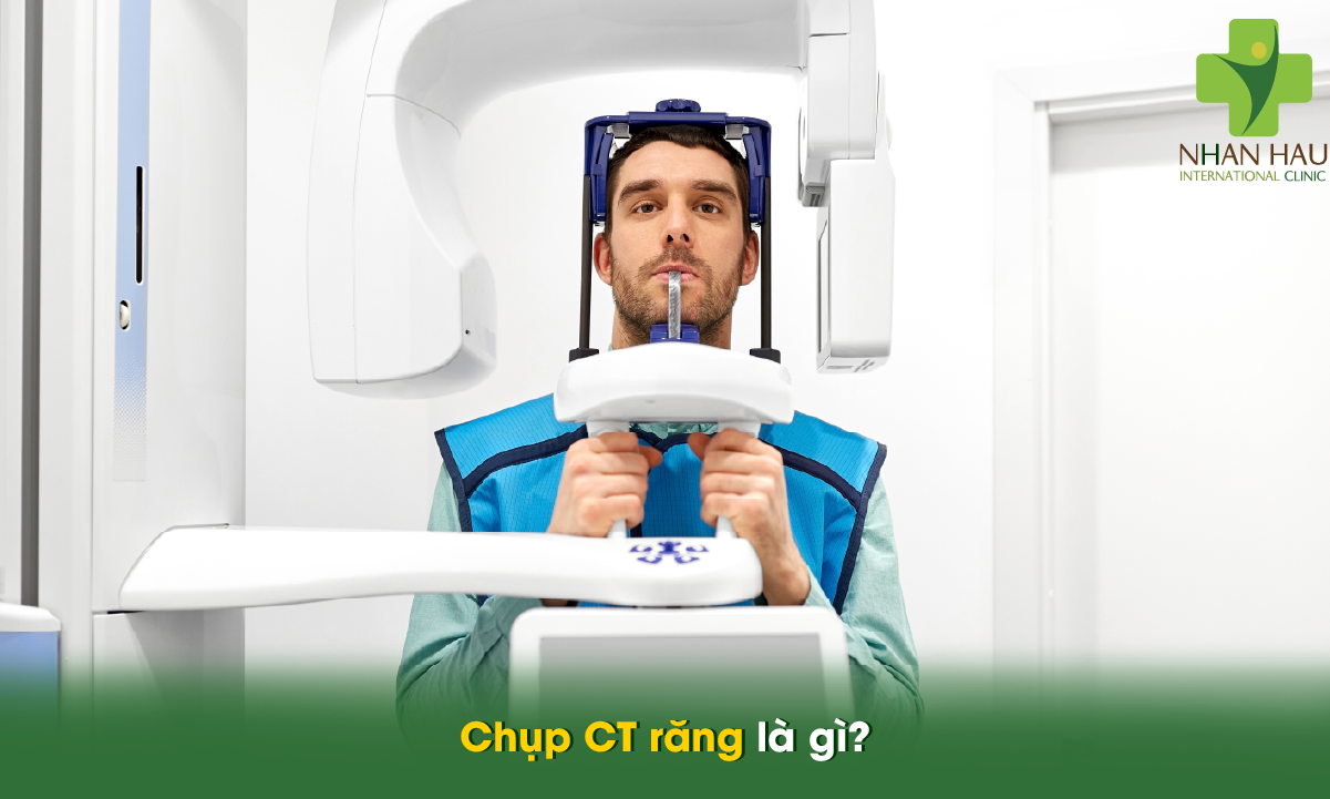 Chụp CT răng: Công nghệ chẩn đoán an toàn và chính xác trong nha khoa 1 Chụp CT răng là gì?