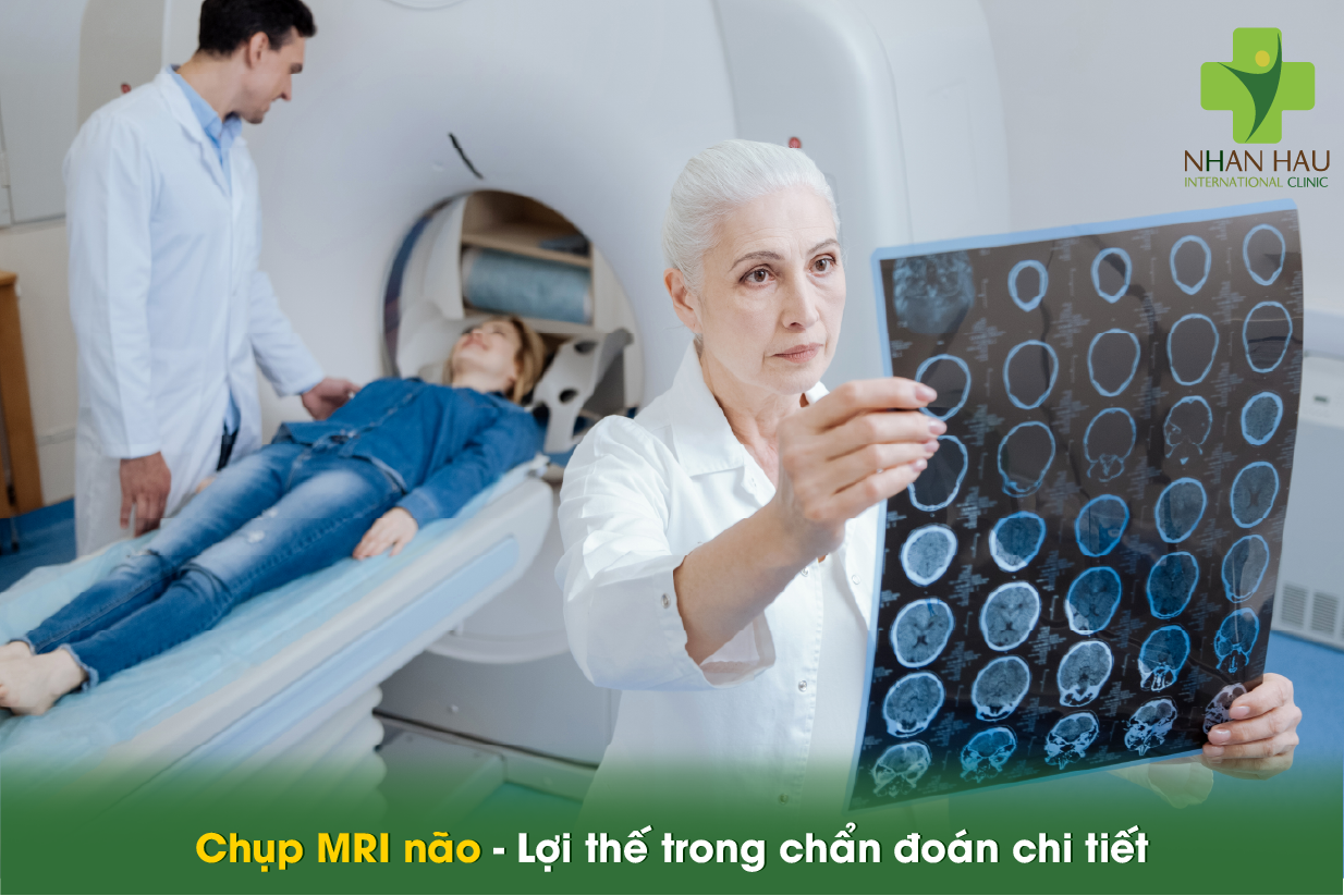 Đau đầu nên chụp CT hay MRI? Bác sĩ hướng dẫn chọn đúng phương pháp 3 Chụp MRI não - Lợi thế trong chẩn đoán chi tiết
