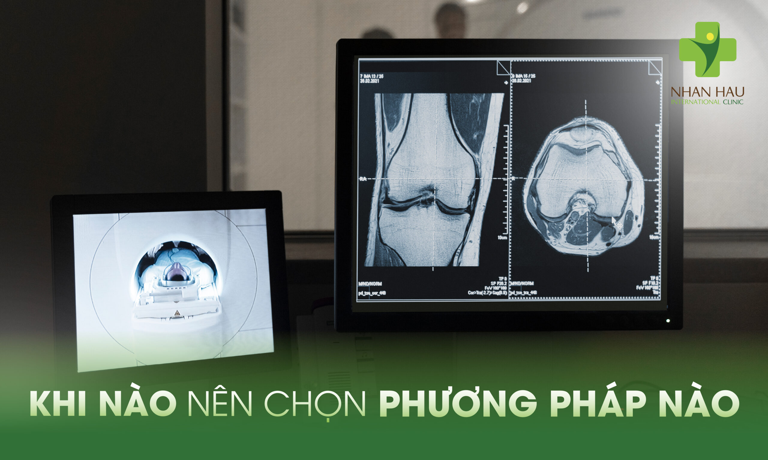 Khi Nào Nên Chọn Phương Pháp Nào?